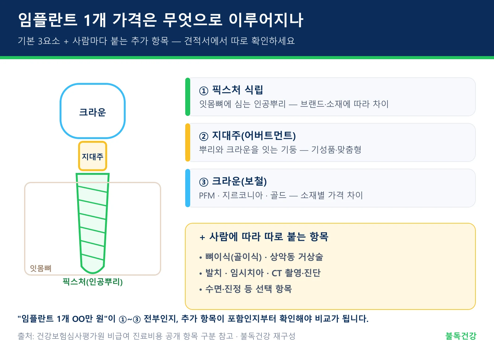 임플란트 1개 가격 구성 — 픽스처 지대주 크라운과 뼈이식 등 추가 항목